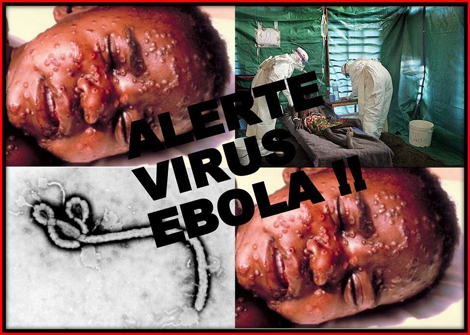 Virus Ebola gây tử vong đến 90%
