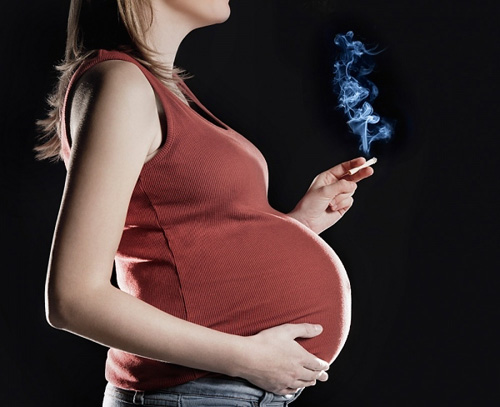 Hút thuốc khi mang thai làm tăng nguy cơ hở vòm miệng, sứt môi của  bé