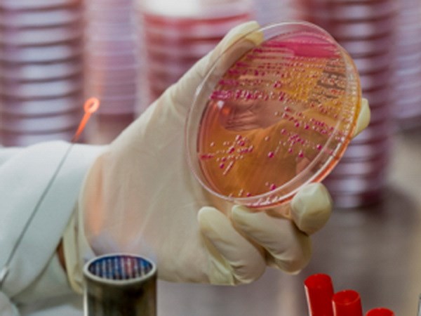 Phát hiện siêu vi khuẩn khánh nhiều loại kháng sinh tại Việt Nam