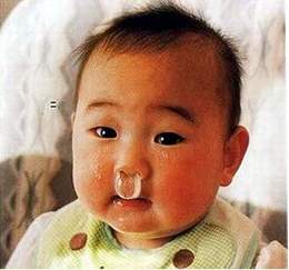  Chảy nước mũi là một dấu hiệu trẻ bị viêm đường hô hấp trên.