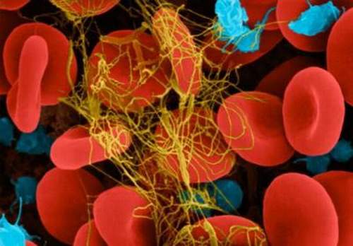Sắt cần thiết để tạo hemoglobin, một chất trong hồng cầu và giúp hồng cầu thực hiện chức năng vận chuyển ôxy.