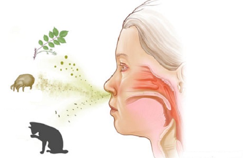 Đối phó hiệu quả với viêm mũi dị ứng khi chuyển mùa