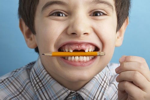 Răng trẻ bị chấn thương, cần xử lí thế nào?