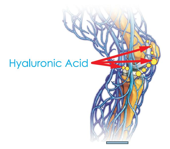 Điều trị thoái hóa khớp: Bổ sung acid hyaluronic thế nào?